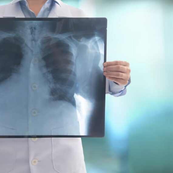 How to Become a Radiologic Technologist